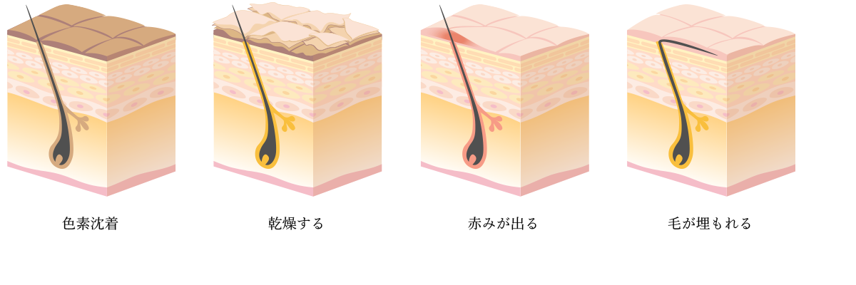 自己処理を続けると？